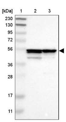 Western Blot: Proteasome 26S S5 Antibody [NBP1-87800]