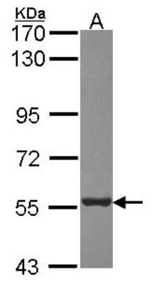 Western Blot: Proteasome 26S S5 Antibody [NBP2-19956]