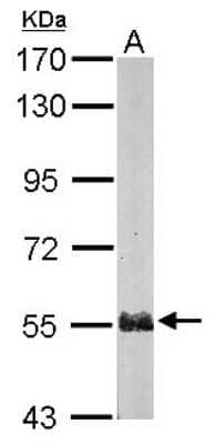 Western Blot: Proteasome 26S S5 Antibody [NBP2-19956]