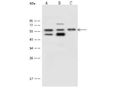 Western Blot: Proteasome 26S S5 Antibody [NBP2-99617]