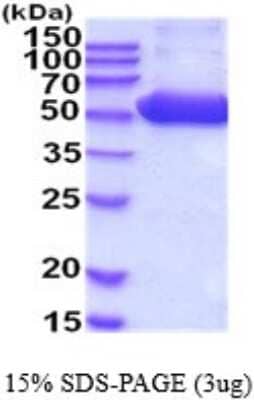 SDS-PAGE: Recombinant Human Proteasome 26S S5 His Protein [NBP2-52158]