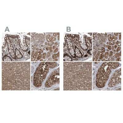 Immunohistochemistry-Paraffin: Proteasome beta 1 Antibody [NBP1-89714]