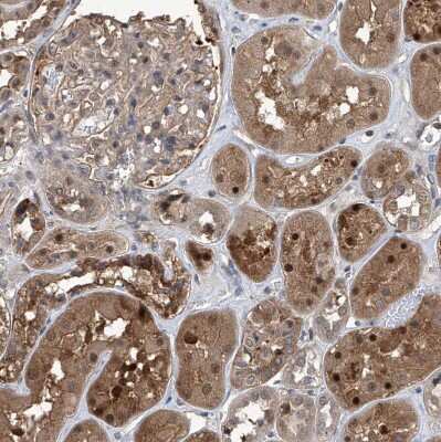 Immunohistochemistry-Paraffin: Proteasome beta 1 Antibody [NBP1-89714]