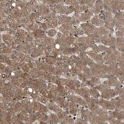 Immunohistochemistry-Paraffin: Proteasome beta 1 Antibody [NBP1-89714]