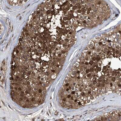 Immunohistochemistry-Paraffin: Proteasome beta 1 Antibody [NBP1-89714]
