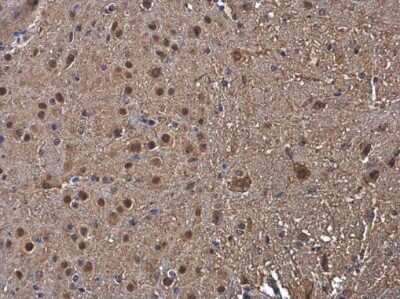 Immunohistochemistry-Paraffin: Proteasome beta 1 Antibody [NBP3-12968]