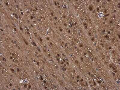Immunohistochemistry-Paraffin: Proteasome beta 1 Antibody [NBP3-12968]