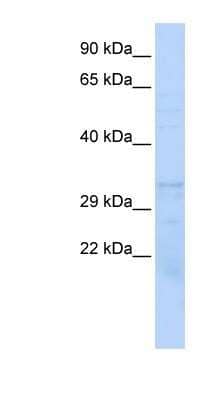 Western Blot: Proteasome beta 1 Antibody [NBP1-54583]