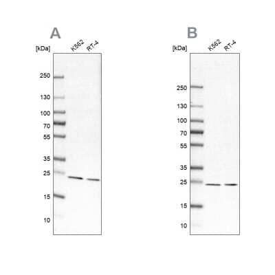 Western Blot: Proteasome beta 1 Antibody [NBP1-89713]