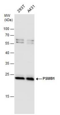 Western Blot: Proteasome beta 1 Antibody [NBP3-12968]