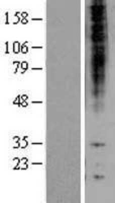 Western Blot: Proteasome beta 1 Overexpression Lysate [NBL1-14876]