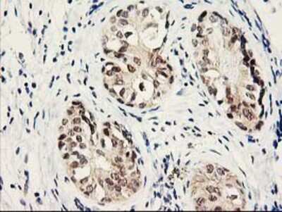 Immunohistochemistry-Paraffin: Proteasome subunit beta type 4 Antibody (OTI2C9) [NBP2-01225]