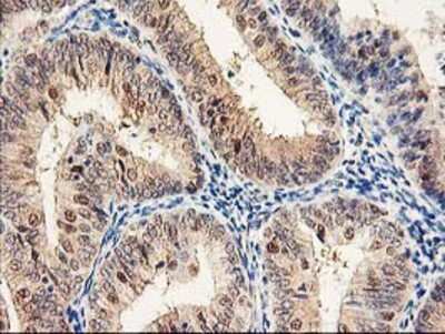 Immunohistochemistry-Paraffin: Proteasome subunit beta type 4 Antibody (OTI2C9) [NBP2-01225]