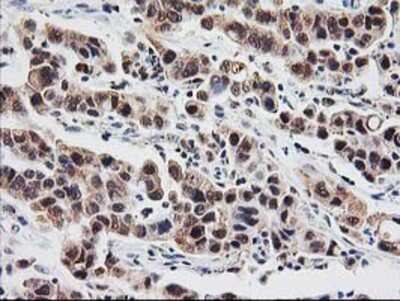 Immunohistochemistry-Paraffin: Proteasome subunit beta type 4 Antibody (OTI2C9) [NBP2-01225]