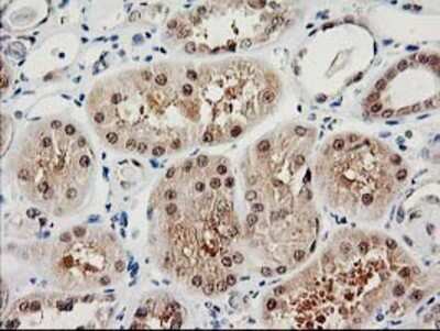 Immunohistochemistry-Paraffin: Proteasome subunit beta type 4 Antibody (OTI2C9) [NBP2-01225]