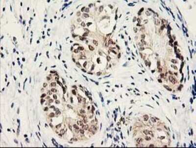 Immunohistochemistry: Proteasome subunit beta type 4 Antibody (OTI2C9) - Azide and BSA Free [NBP2-73655]