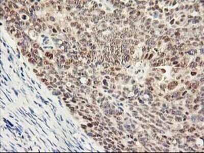 Immunohistochemistry: Proteasome subunit beta type 4 Antibody (OTI2C9) - Azide and BSA Free [NBP2-73655]