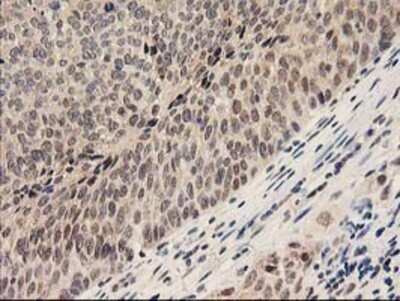 Immunohistochemistry: Proteasome subunit beta type 4 Antibody (OTI2C9) - Azide and BSA Free [NBP2-73655]