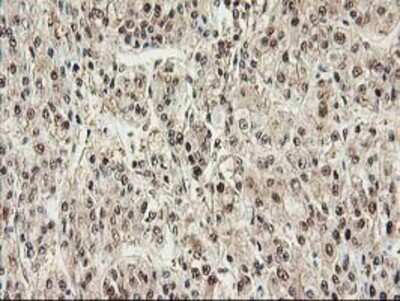 Immunohistochemistry: Proteasome subunit beta type 4 Antibody (OTI2C9) - Azide and BSA Free [NBP2-73655]