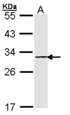 Western Blot: Proteasome subunit beta type 4 Antibody [NBP1-32009]