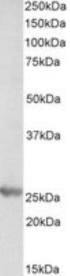 Western Blot: Proteasome subunit beta type 4 Antibody [NBP1-52080]