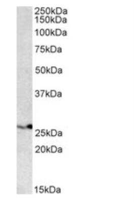 Western Blot: Proteasome subunit beta type 4 Antibody [NBP1-52080]