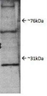 Western Blot: Proteasome subunit beta type 4 Antibody [NBP1-54592]