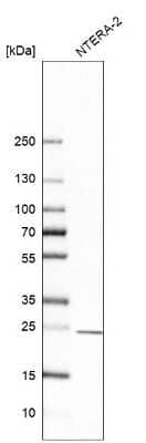 Western Blot: Proteasome subunit beta type 4 Antibody [NBP1-89681]