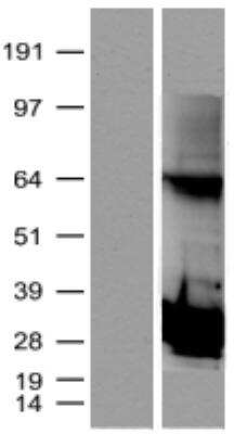 Western Blot: Proteasome subunit beta type 4 Overexpression Lysate [NBL1-14879]