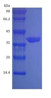 SDS-PAGE: Recombinant Protein A His (C-Term) Cys (C-Term) Protein [NBP2-35014]