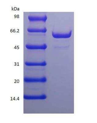 SDS-PAGE: Recombinant Protein A/G His (C-Term) Protein [NBP2-34981]
