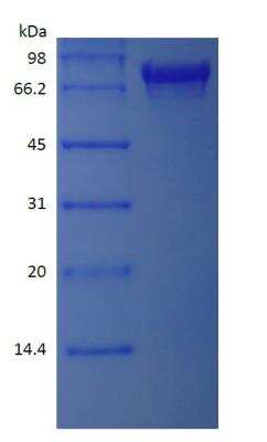 SDS-PAGE: Recombinant Protein A/G/L Protein [NBP2-34985]