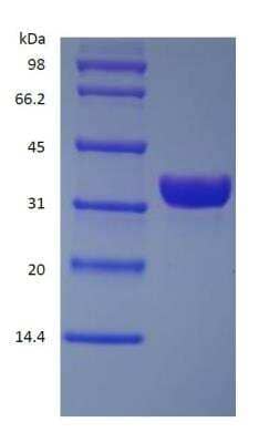 SDS-PAGE: Recombinant Protein A His (C-Term) Protein [NBP2-34965]