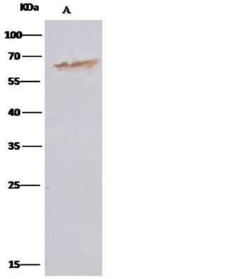 Immunoprecipitation: Protein Disulfide Isomerase/P4HB Antibody (16) [NBP2-89676]