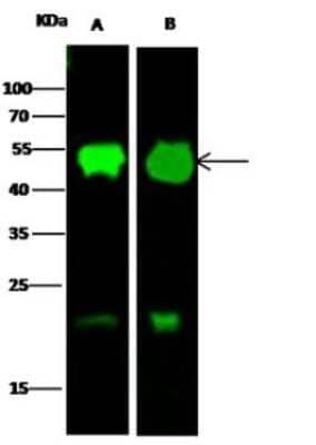 Western Blot: Protein Disulfide Isomerase/P4HB Antibody (16) [NBP2-89676]