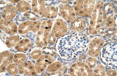 Immunohistochemistry-Paraffin: Protein Disulfide Isomerase/P4HB Antibody [NBP1-57949]