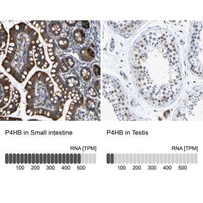 Immunohistochemistry-Paraffin: Protein Disulfide Isomerase/P4HB Antibody [NBP1-84051]