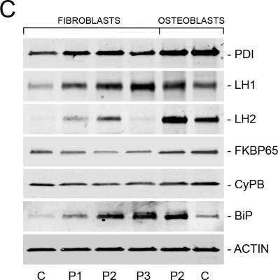 Western Blot: Protein Disulfide Isomerase/P4HB Antibody [H00005034-B01P]