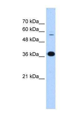 Western Blot: Protein Disulfide Isomerase/P4HB Antibody [NBP1-57949]