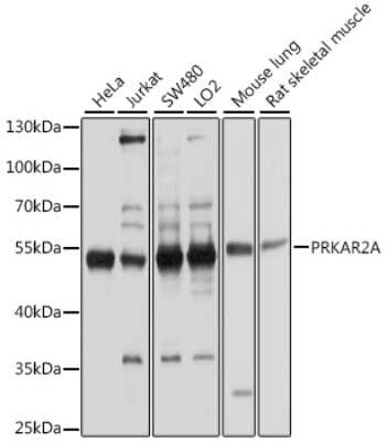 Western Blot: Protein Kinase A Regulatory Subunit II alpha AntibodyAzide and BSA Free [NBP3-03477]