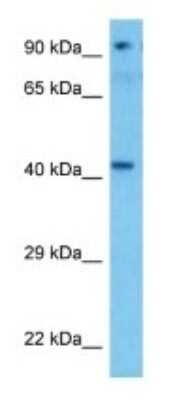 Western Blot: Protein Kinase A Regulatory Subunit II alpha Antibody [NBP3-09404]