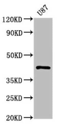 Western Blot: Protein Kinase A regulatory subunit I alpha Antibody (1C3) [NBP3-15192]