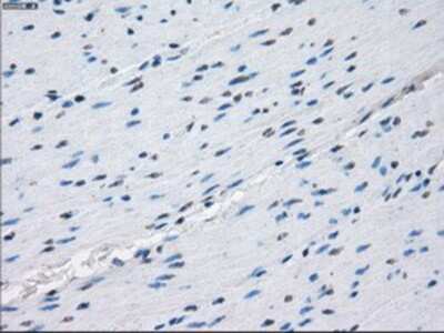 Immunohistochemistry-Paraffin: Protein Kinase A regulatory subunit I alpha Antibody (OTI6C7) [NBP1-47935]