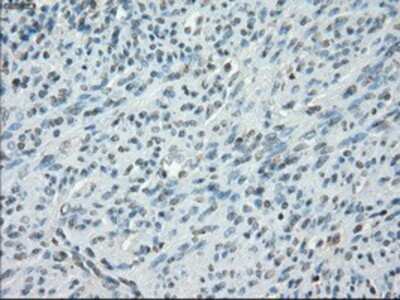 Immunohistochemistry-Paraffin: Protein Kinase A regulatory subunit I alpha Antibody (OTI6C7) [NBP1-47935]