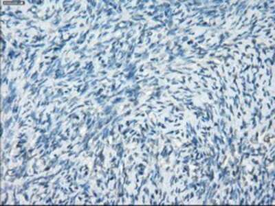 Immunohistochemistry-Paraffin: Protein Kinase A regulatory subunit I alpha Antibody (OTI6C7) [NBP1-47935]