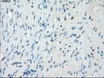 Immunohistochemistry-Paraffin: Protein Kinase A regulatory subunit I alpha Antibody (OTI6C7) [NBP1-47935]