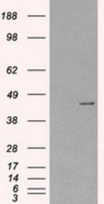 Western Blot: Protein Kinase A regulatory subunit I alpha Antibody (OTI6C7) [NBP1-47935]