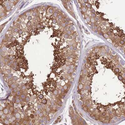 Immunohistochemistry-Paraffin: Protein Kinase A regulatory subunit I alpha Antibody [NBP2-33585]