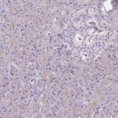 Immunohistochemistry-Paraffin: Protein Kinase A regulatory subunit I alpha Antibody [NBP2-33585]