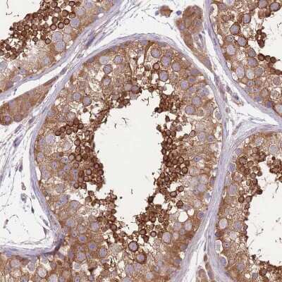Immunohistochemistry-Paraffin: Protein Kinase A regulatory subunit I alpha Antibody [NBP2-33585]
